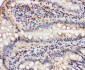 Anti-VCP Antibody